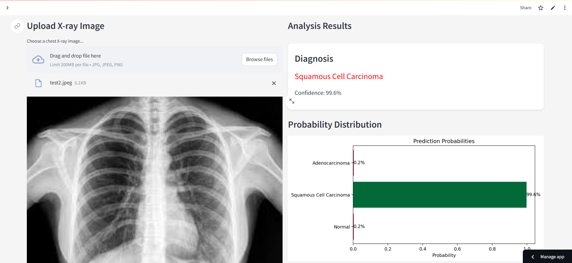 Lung Scan UI